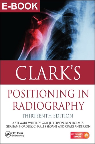 Clark's Positioning in Radiography